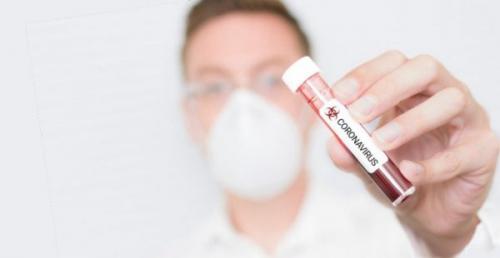 Как отличить ОРВИ от коронавируса. Коронавирус: 6 главных симптомов, отличия от ОРВИ и гриппа