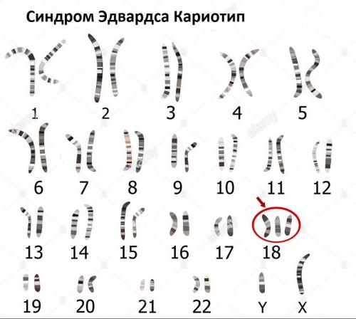 Отличия половых хромосом от обычных хромосом