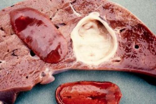 Плоские черви интересные факты. Интересные факты о плоских червях. 02