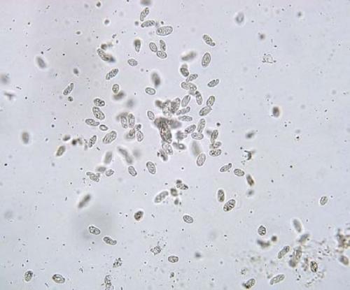 Интересные факты о инфузории туфельки. Инфузория туфелька