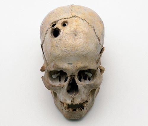 Факты о древней медицине. Медицина Месопотамии