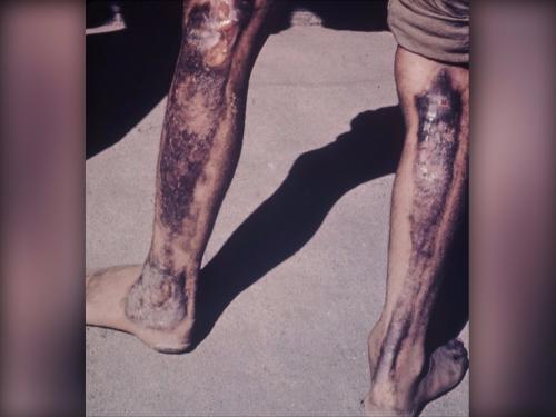 В каком году хиросима Нагасаки была взорвана. Ад для мирных жителей