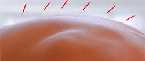 Интересные темы по медицине. Интересные факты о медицине Древнего Китая