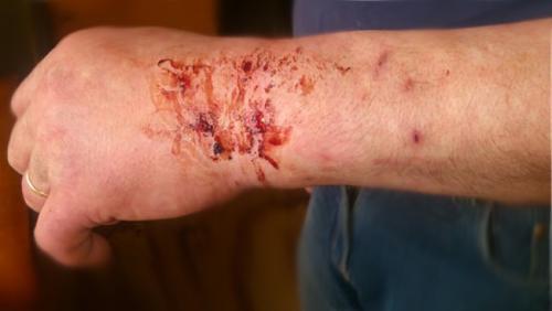 Болезни енотов. ЧЕМ ОПАСНЫ ЕНОТЫ: Болезни, переносимые енотами