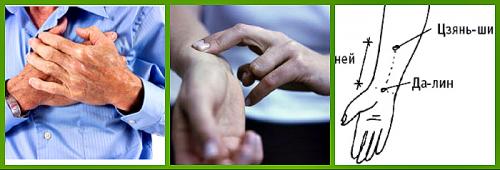 Акупунктурный массаж рук и расположение точек на ладонях. Нахождение точек на ладони 01
