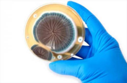 Что такое плесень. Плесень: что такое, какой бывает и почему появляется