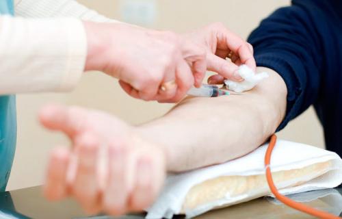 Высокий уровень тестостерона у мужчин. Как определить уровень гормона?