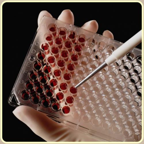 Как научиться разбираться в анализе крови. Как читать анализ крови в 2019 году