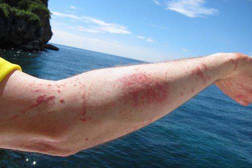 Интересные факты о кораллах и медузах. Интересные факты о кораллах 10