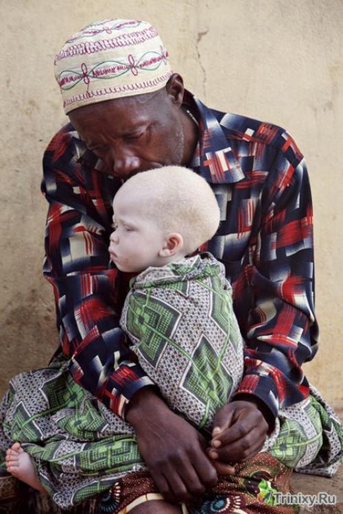 Альбинос негр. Жуткая судьба альбиносов Танзании (11 фото)