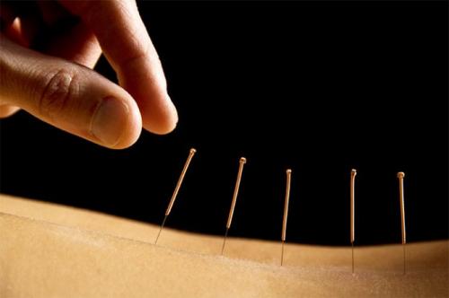 Атлас точек акупунктуры и китайской медицины. Разница между акупрессурой и акупунктурой