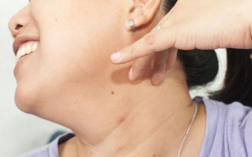 Трюки с языком. Достать языком до кончика носа или подбородка