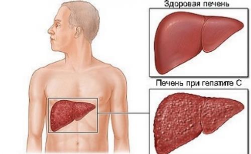 Ежедневное вздутие живота. О предпосылках