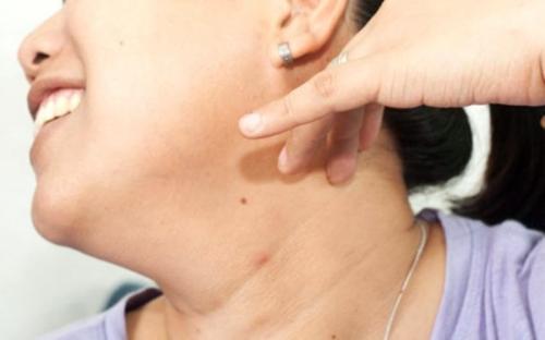 Достаю языком до носа. Трюки с телом, которые не каждый сможет сделать