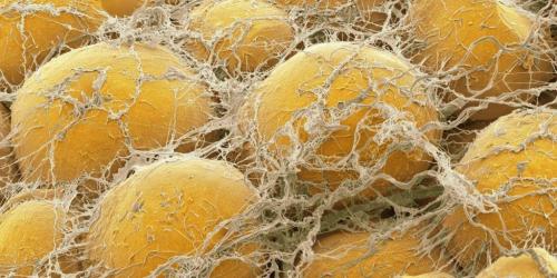 Можно ли поправиться от кофе 3 .  Что происходит при похудении