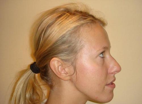 Мочки ушей о чем говорят. Характер можно определить по форме ушей