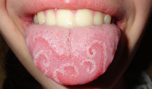 Аномалии человеческого тела. 10 страшных и удивительных аномалий, которые преследуют человека (10 фото)