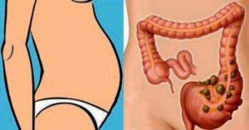 Вздутие живота запор лечение народными средствами. Раскрываем секреты лечения вздутия живота народными средствами — Вмоменте