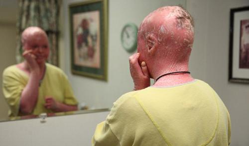 Аномалии человеческого тела. 10 страшных и удивительных аномалий, которые преследуют человека (10 фото)