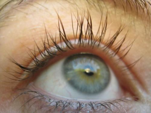 Живые волосы мутация. Самые интересные генетические мутации в мире