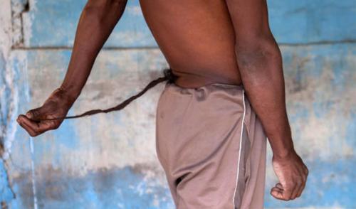 Аномалии человеческого тела. 10 страшных и удивительных аномалий, которые преследуют человека (10 фото)