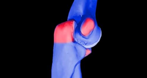 Что будет с организмом если каждый день есть чеснок. Что произойдет с Вашим организмом, если каждый день есть чеснок?