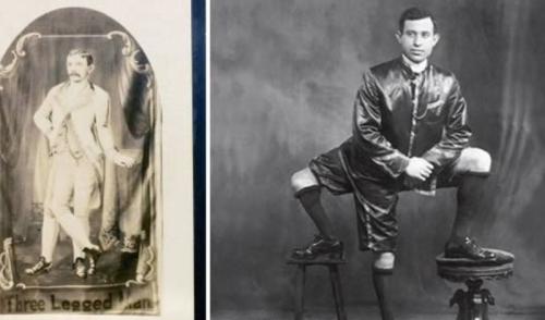 Аномалии человеческого тела. 10 страшных и удивительных аномалий, которые преследуют человека (10 фото)