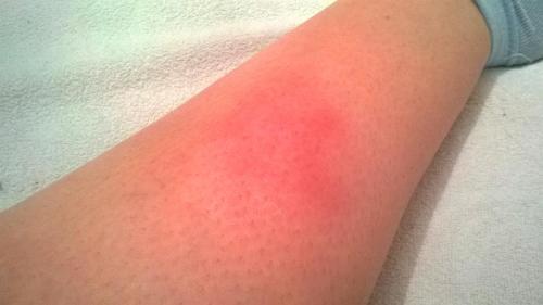 Чай с облепихой и имбирем