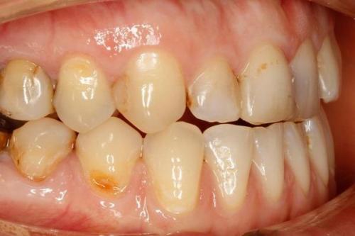 Как терпеть боль. Как научиться терпеть боль: практические рекомендации 02