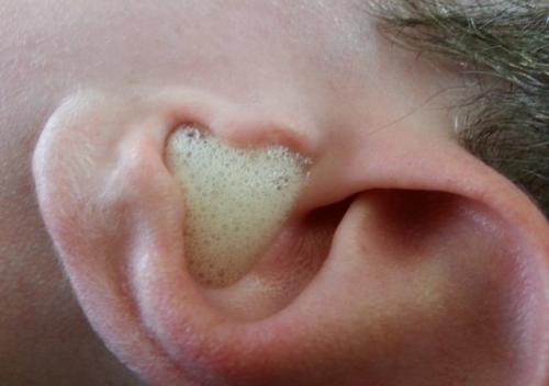 Перекись водорода от. Как принимать перекись водорода внутрь