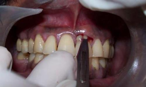 Как терпеть боль. Как научиться терпеть боль: практические рекомендации 03