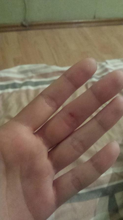 Стриж не ест. Спасение стрижа