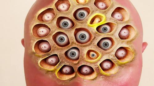 Кластерные отверстия в коже причины. Причины возникновения фобии