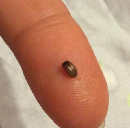 Жучки в ковре, что это. Ковровый кожеед: все о вредителе