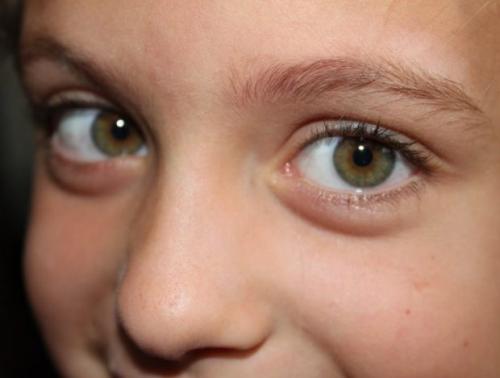 Самый необычный цвет глаз. Самые редкие цвета глаз у человека: 10 удивительных фото