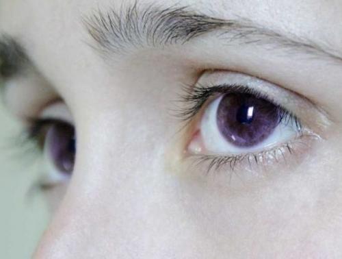 Самый необычный цвет глаз. Самые редкие цвета глаз у человека: 10 удивительных фото