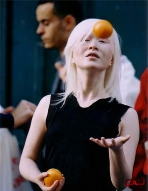 Певица альбинос. Альбиносы