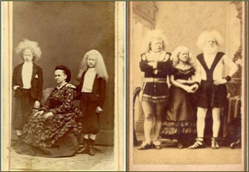 Певица альбинос. Альбиносы