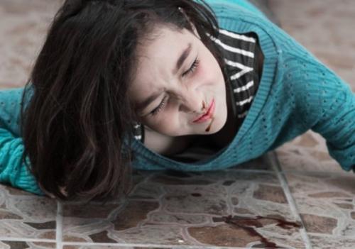 Что следует сделать пострадавшему при вывихе. Что делать при вывихе: первая помощь, симптомы, как лечить