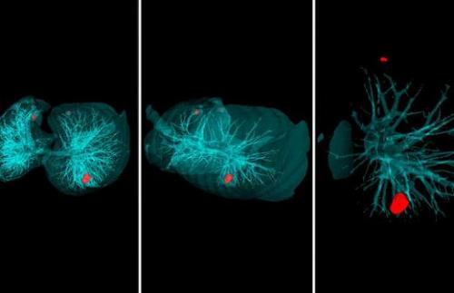 Найдено лекарство от коронавируса? Какие лекарства нужно иметь дома для защиты от коронавируса 04