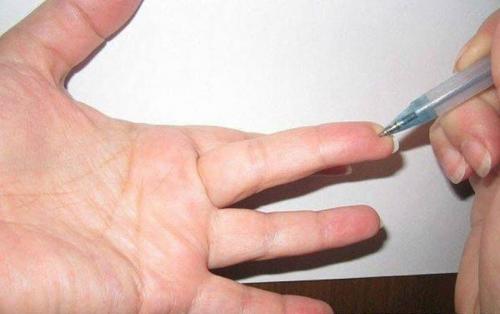 Точки на теле человека для смеха. Волшебные точки на теле человека.