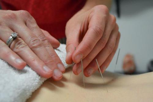 Акупунктурные точки на теле человека. Точки и меридианы