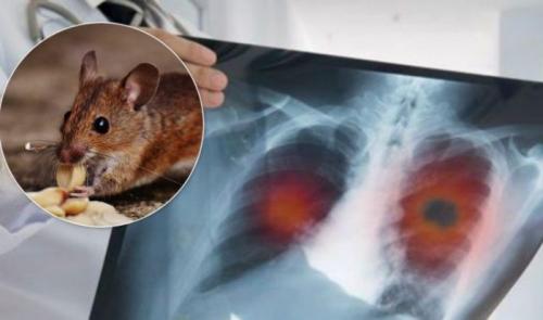 Что известно о китайском вирусе. Хантавирус в Китае в 2020 году и что это такое