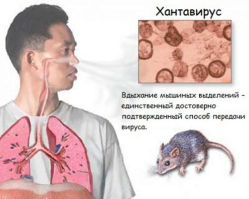 Что известно о китайском вирусе. Хантавирус в Китае в 2020 году и что это такое