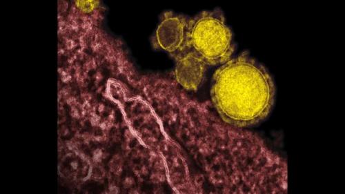 Симптомы коронавируса у человека 2020. Симптомы коронавируса 2020 года у человека: самые важные признаки 13