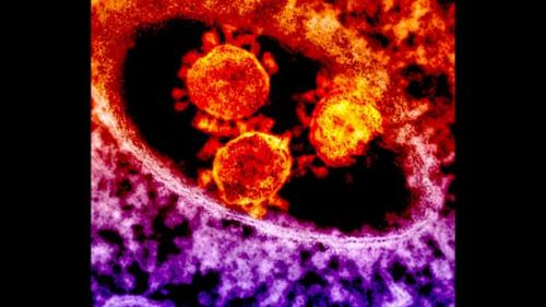 Симптомы коронавируса у человека 2020. Симптомы коронавируса 2020 года у человека: самые важные признаки 06