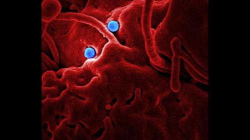 Симптомы коронавируса у человека 2020. Симптомы коронавируса 2020 года у человека: самые важные признаки 10