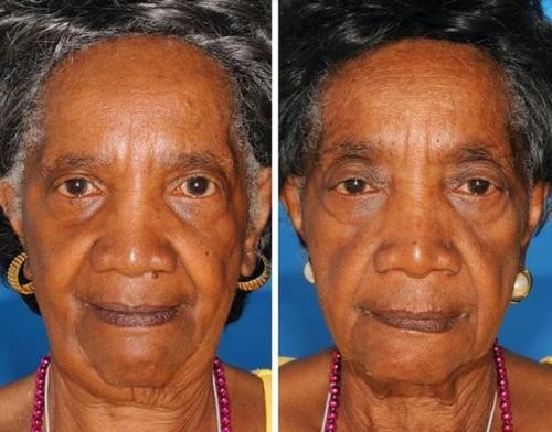 Сестры близнецы одна курит уже 16 лет другая не курила никогда. Как выглядят сестры и братья-близнецы, один из которых курит, а другой — нет 04