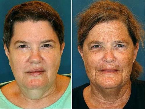 Сестры близнецы одна курит уже 16 лет другая не курила никогда. Как выглядят сестры и братья-близнецы, один из которых курит, а другой — нет 02