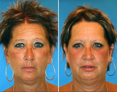 Сестры близнецы одна курит уже 16 лет другая не курила никогда. Как выглядят сестры и братья-близнецы, один из которых курит, а другой — нет 03